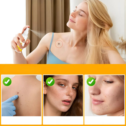 TAG RECEDE - VENENO DE ABEJA – Elimina las verrugas, detén producción de verrugas de forma natural y potente ORIGINAL