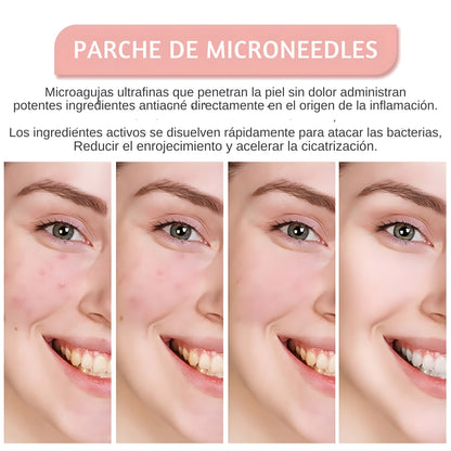 Parches para acné invisibles reparador de cicatrices