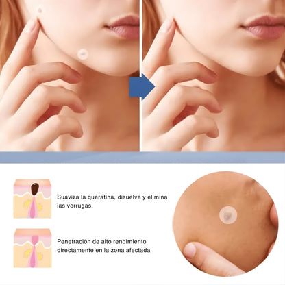 Parches para acné invisibles reparador de cicatrices